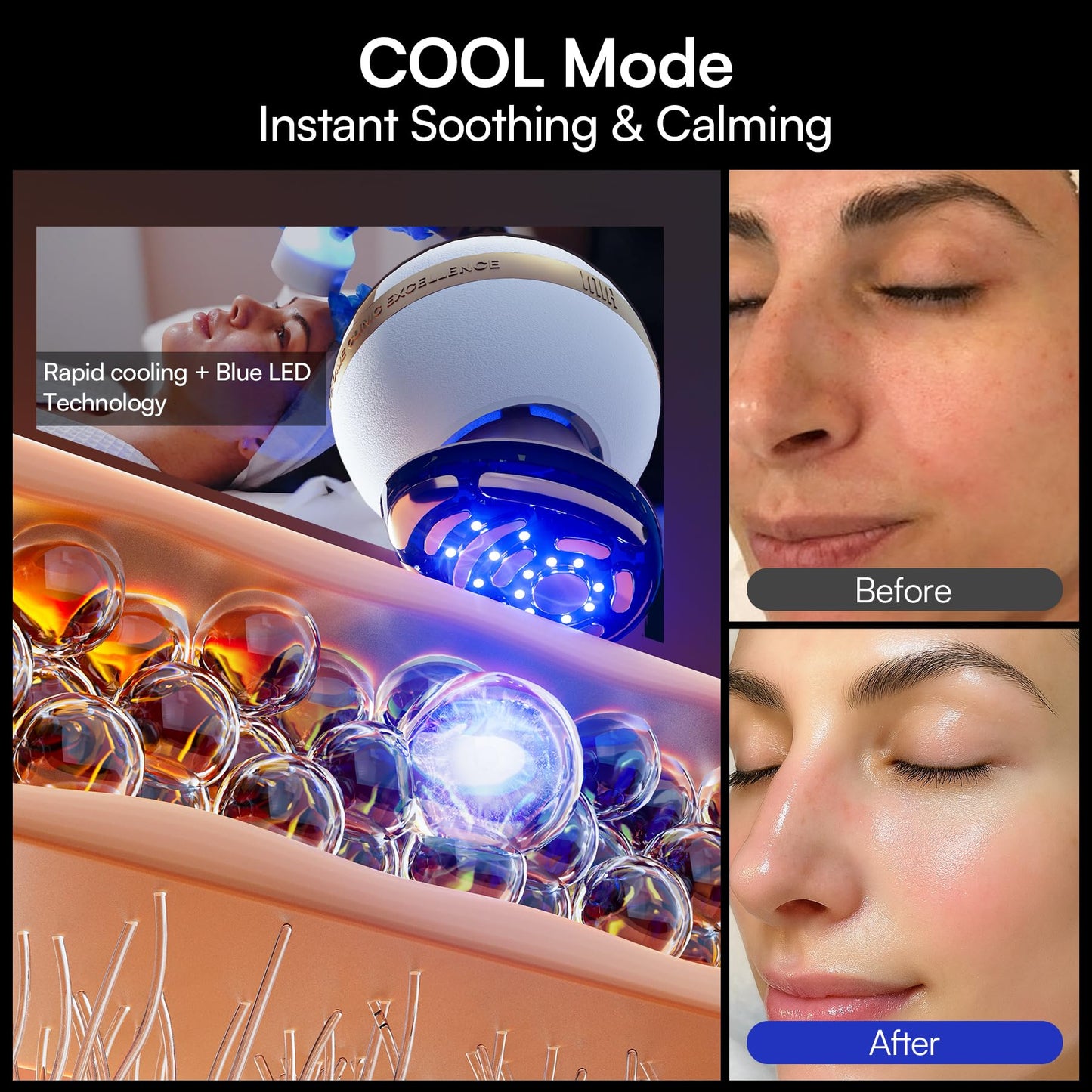 INIA SPHERA 8-in-1 Microcurrent Facial Device for Face & Neck