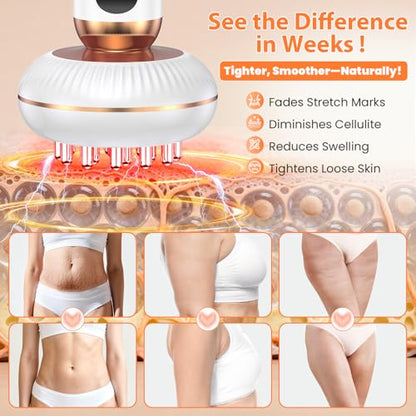 4-in-1 Body Sculpting & Lymphatic Drainage Massager