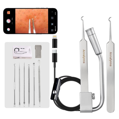 Annalynna Visual Blackhead Remover Tweezers Kit