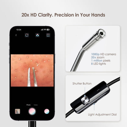 Annalynna Visual Blackhead Remover Tweezers Kit