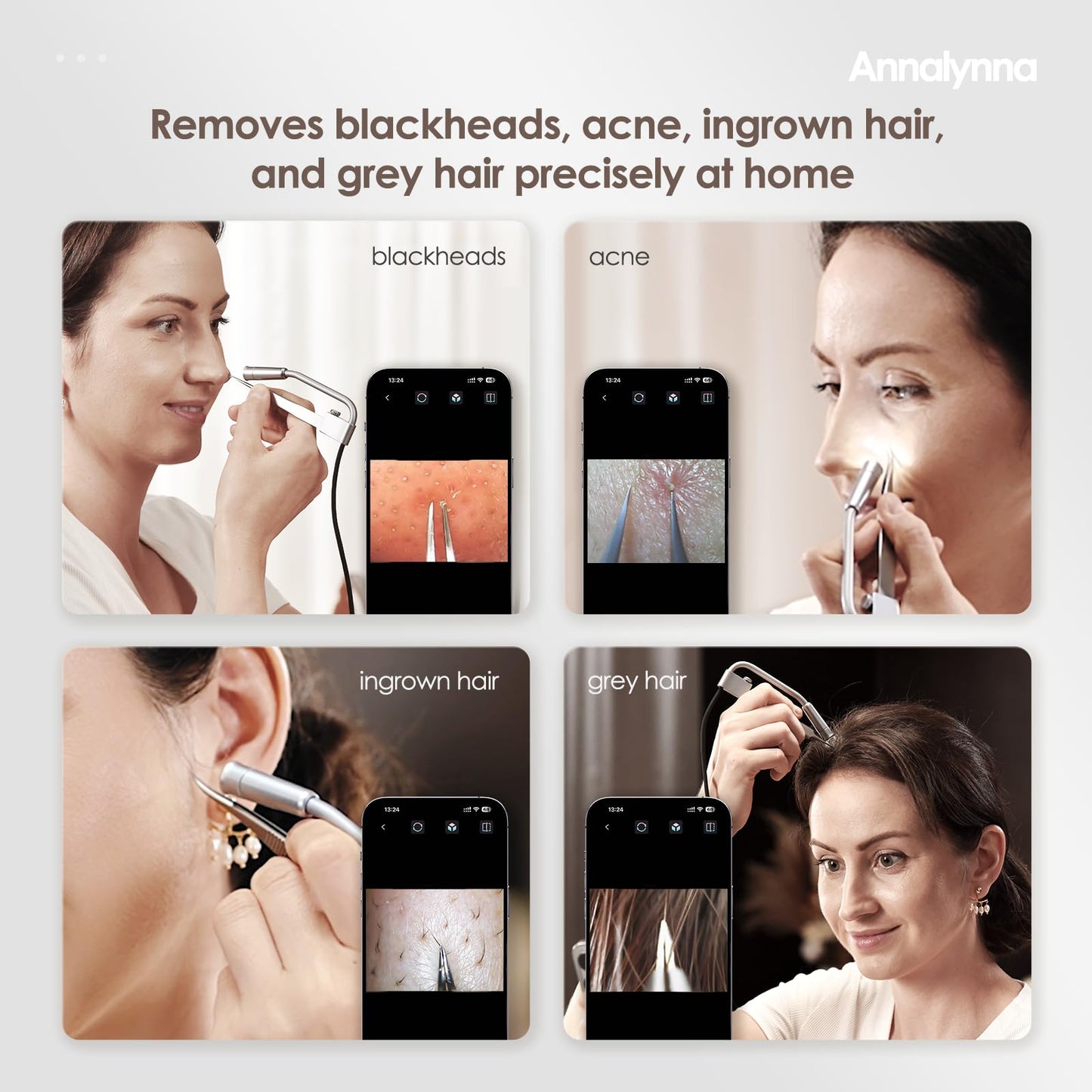 Annalynna Visual Blackhead Remover Tweezers Kit