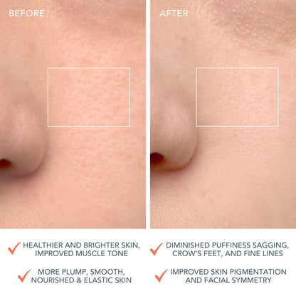 FOREO LUNA 4 Facial Cleansing & Firming Massager