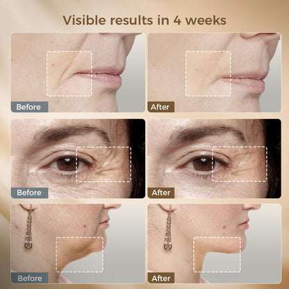 FyneLook Microcurrent Facial Device with Red Light Therapy