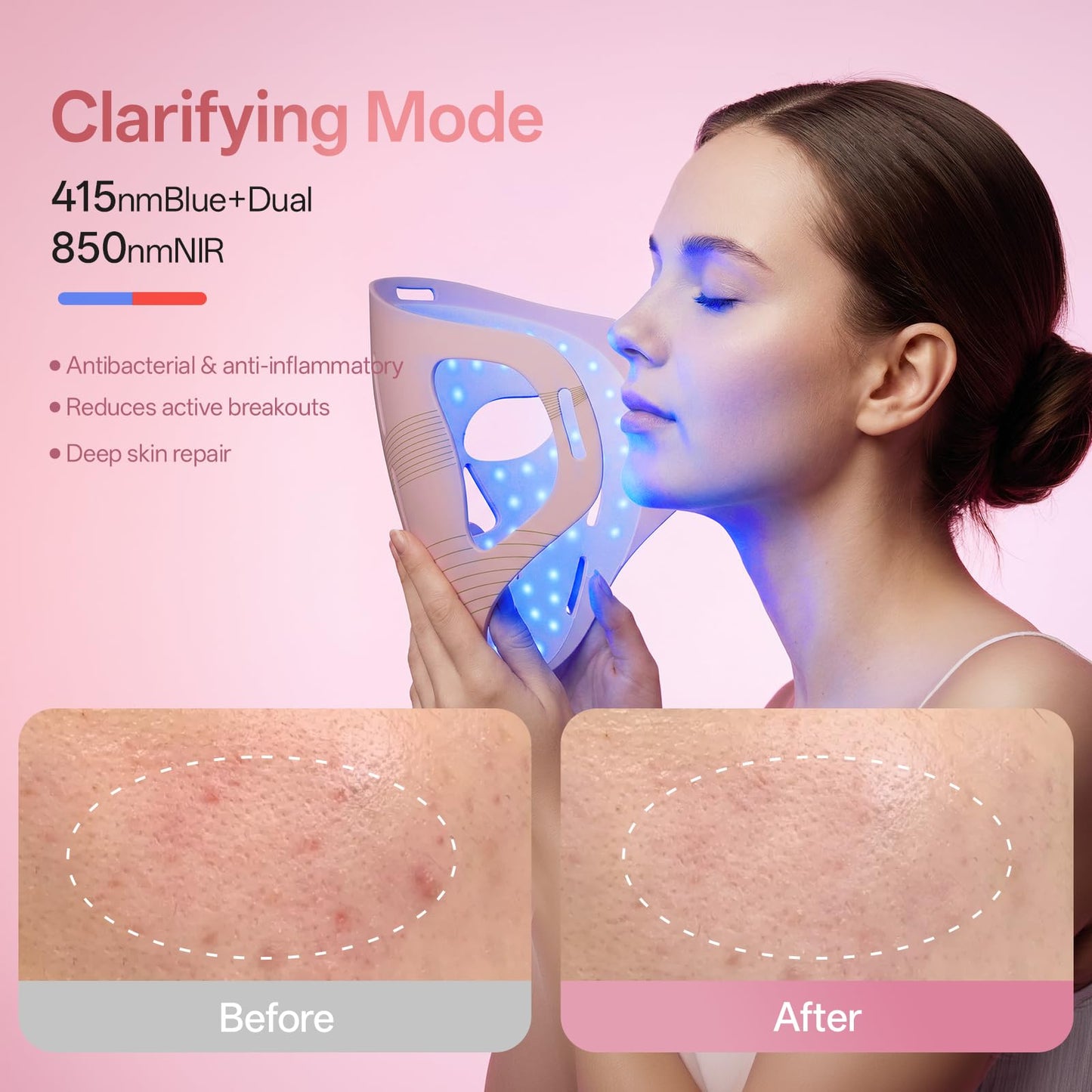 Graart 4D LED Red Light Therapy Face & Jawline Mask