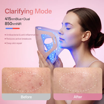 Graart 4D LED Red Light Therapy Face & Jawline Mask