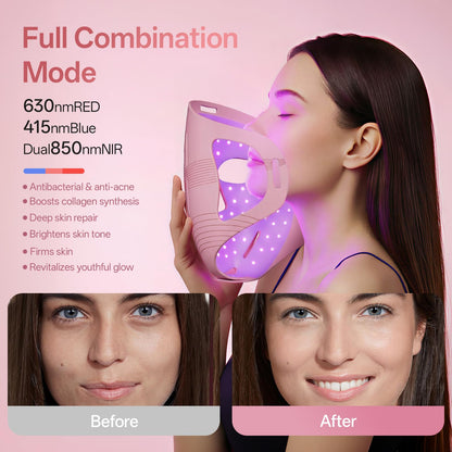 Graart 4D LED Red Light Therapy Face & Jawline Mask