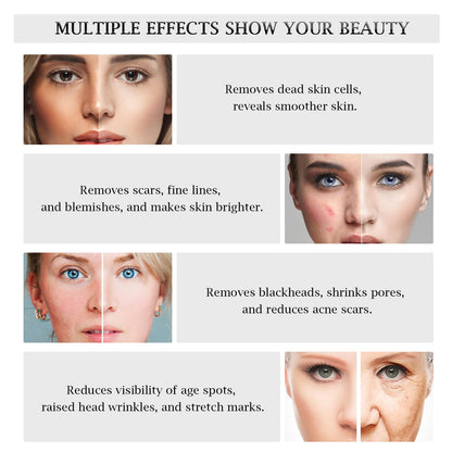 AIMENGXI 3-in-1 Diamond Microdermabrasion Machine