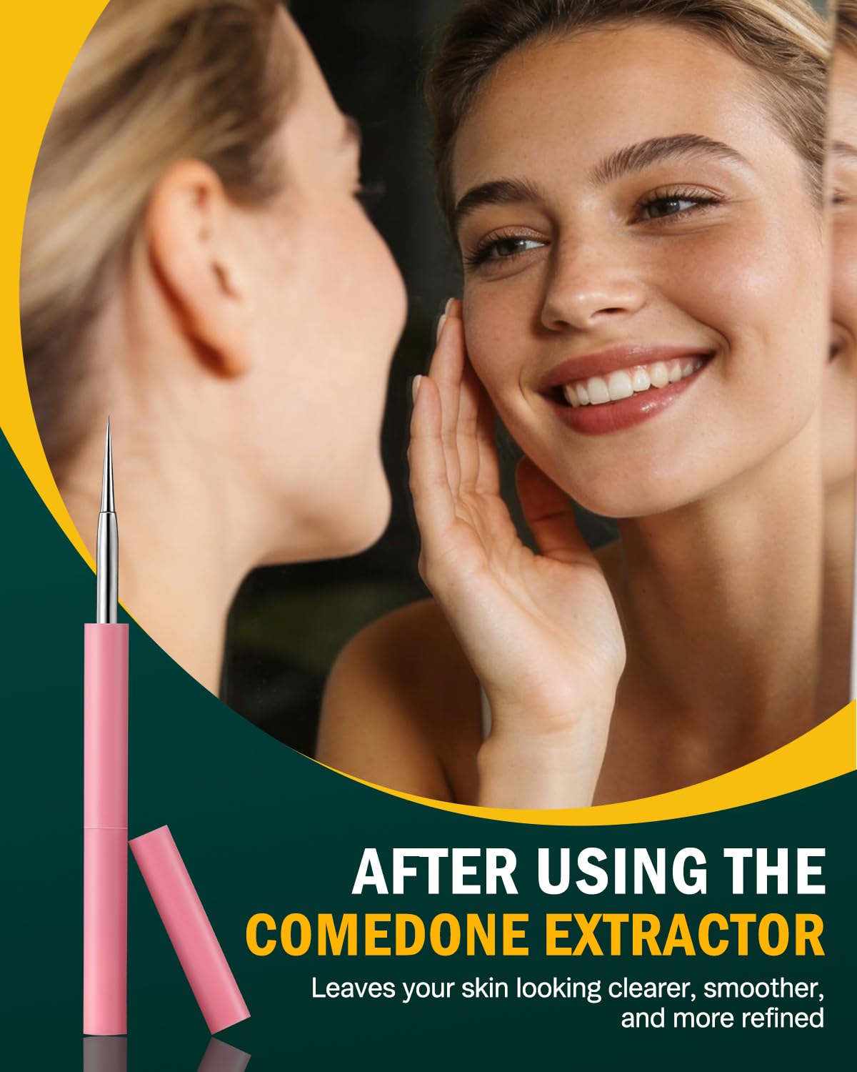 FVION Professional Acne Removal Tool Set