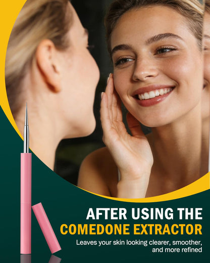 FVION Professional Acne Removal Tool Set