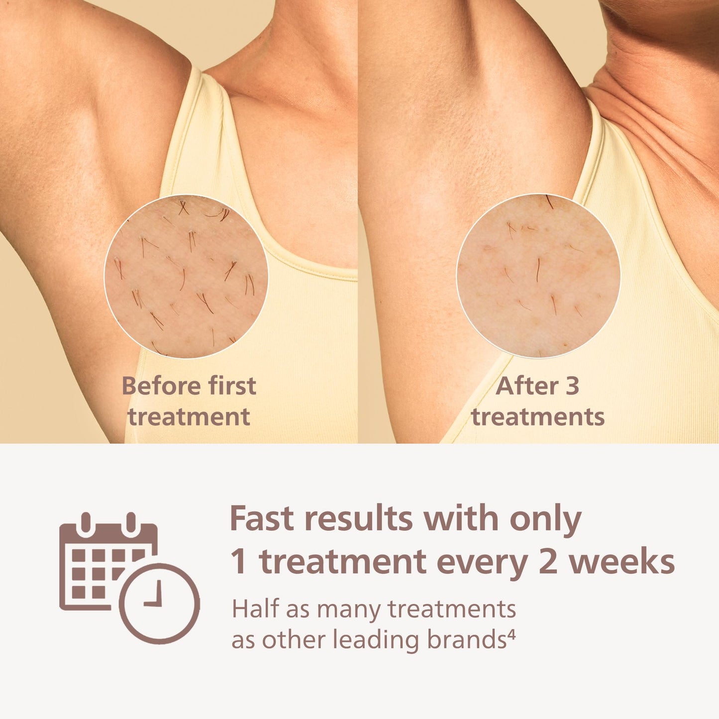Philips Lumea 9000 IPL Hair Removal Device