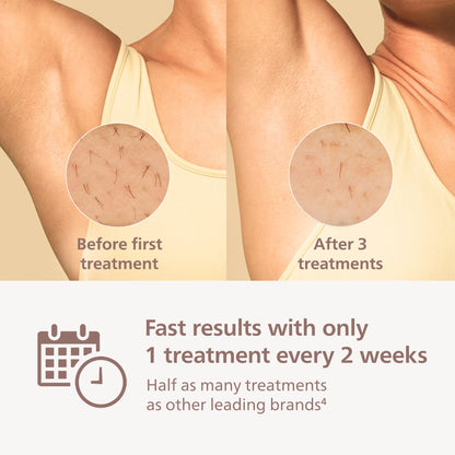 Philips Lumea 9000 IPL Hair Removal Device