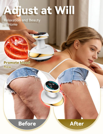 4-in-1 Heated Cellulite Massager with Suction & Rolling Massage