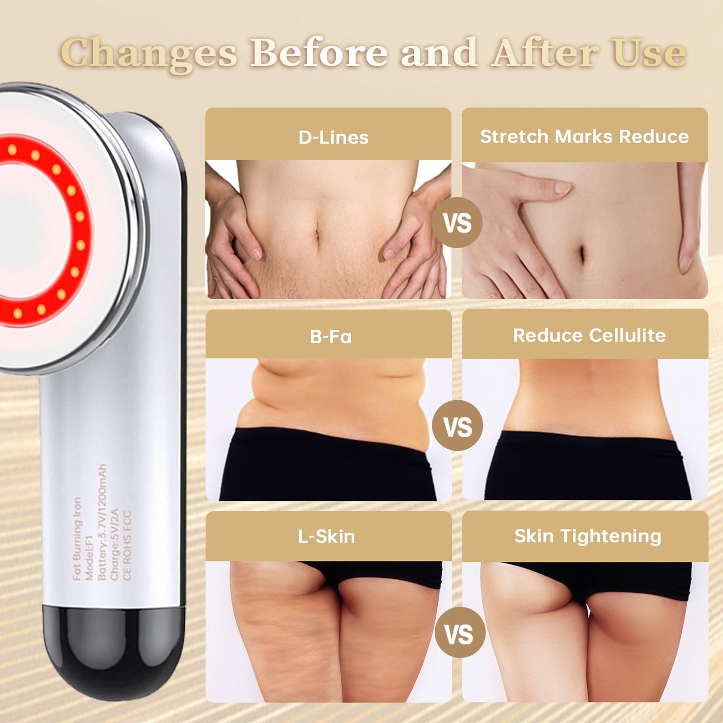 SECOCTSR Body Sculpting & Cellulite Massager with Heat