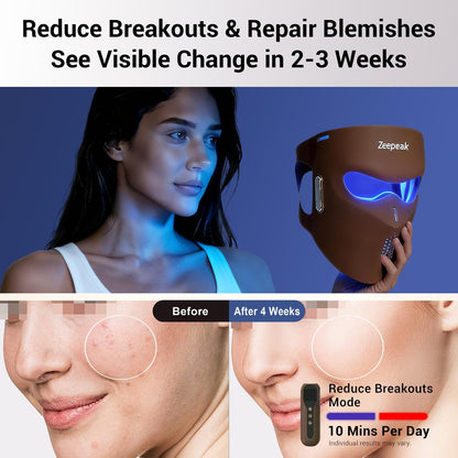Zeepeak 3D LED Red Light Therapy Mask