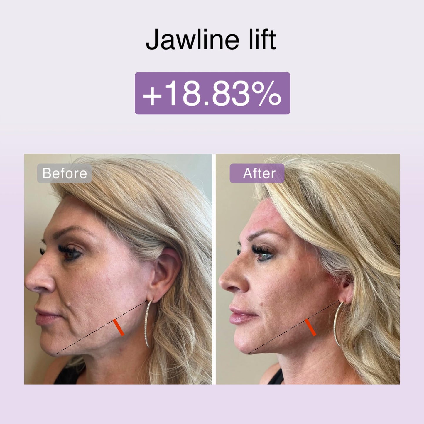 DermRays M1 4-in-1 Facial Toning Tool