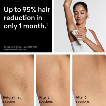 Braun Smart IPL, Silk·Expert Pro 5: at Home Laser Hair Removal for Women and Men