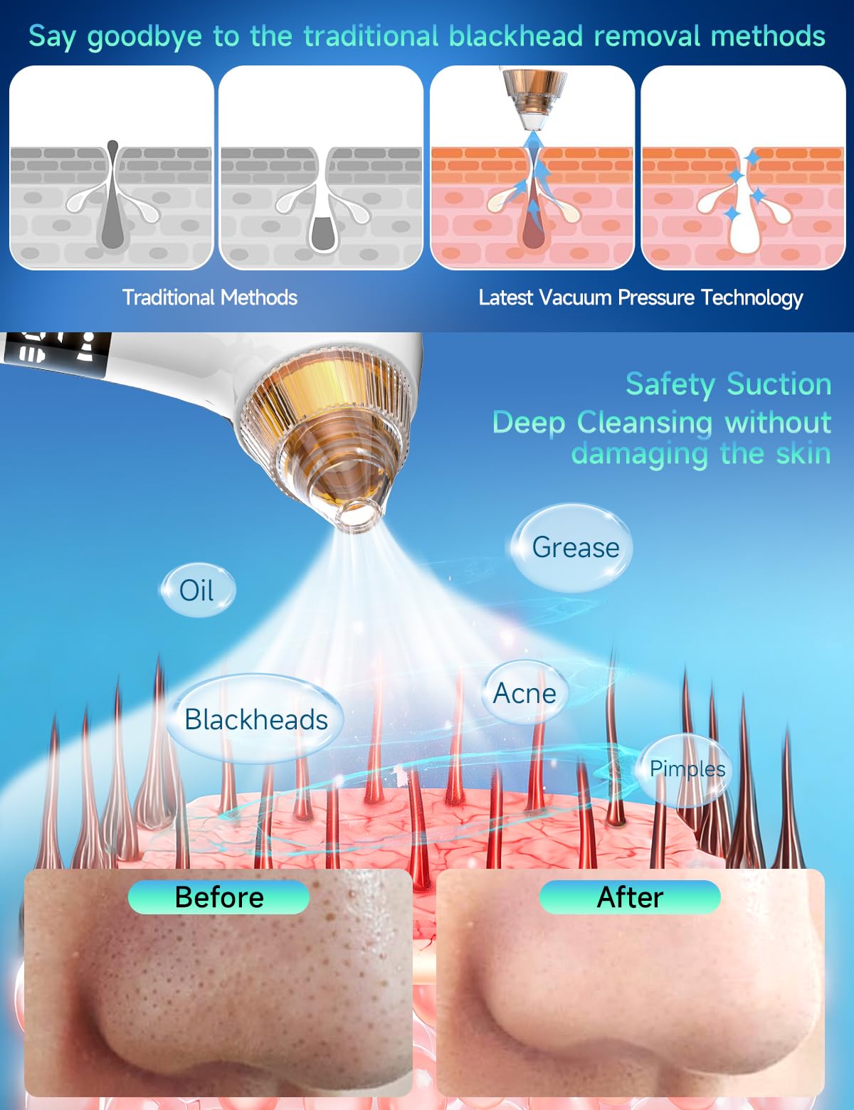 Blackhead Remover Pore Vacuum with Camera & Heating