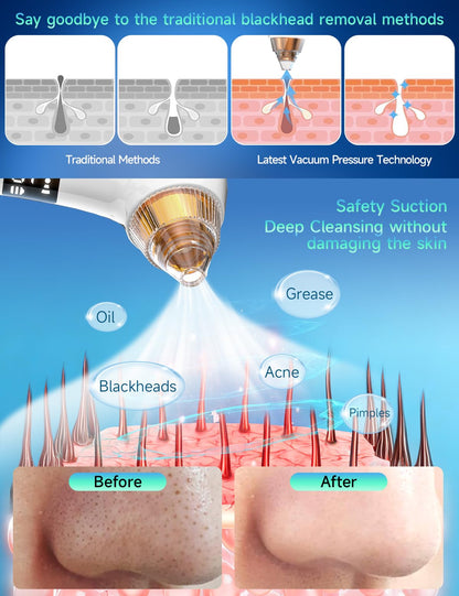 Blackhead Remover Pore Vacuum with Camera & Heating