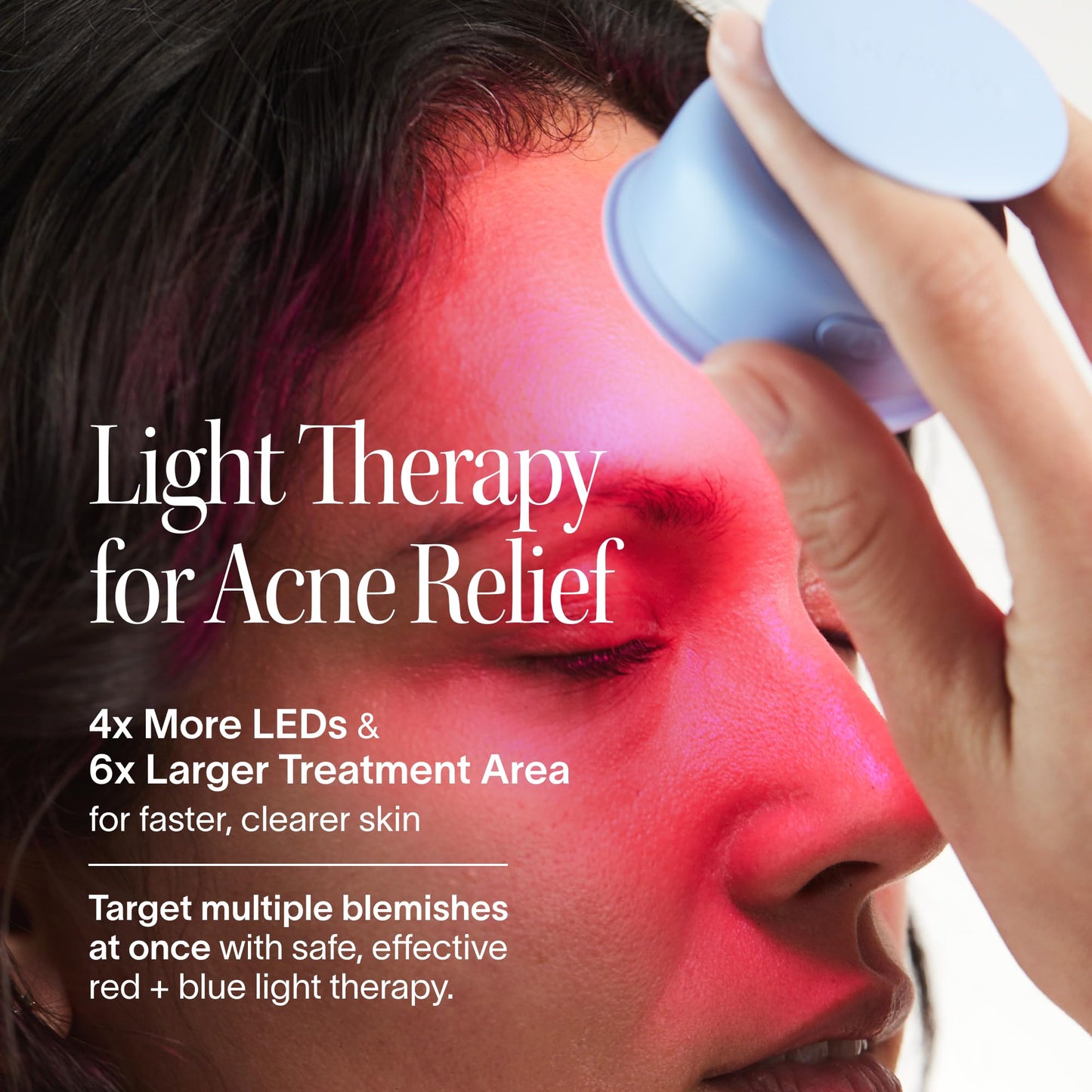 Solawave Bye Acne Light Therapy Wand for Face & Body