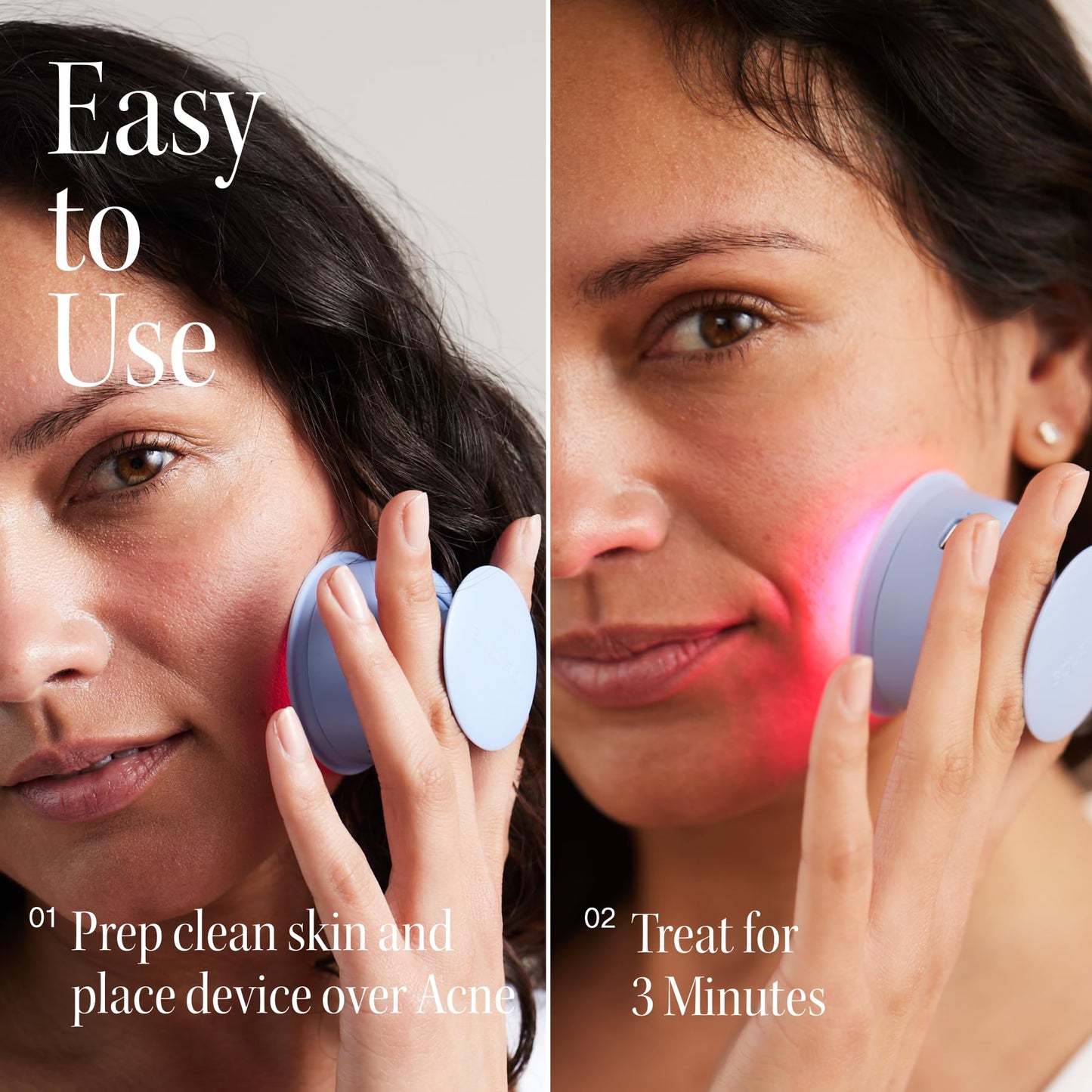 Solawave Bye Acne Light Therapy Wand for Face & Body