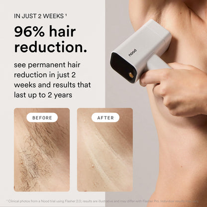NEW Nood™ Flasher Pro — Parent
