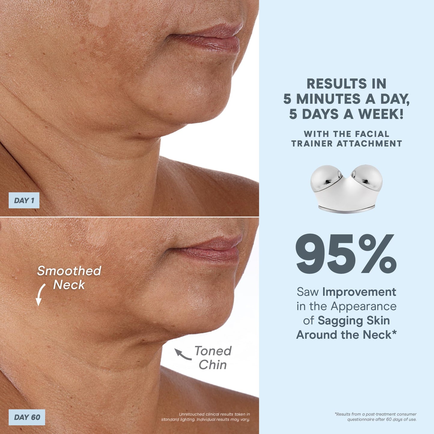 NuFACE TRINITY+ Wrinkle Reducer Attachment